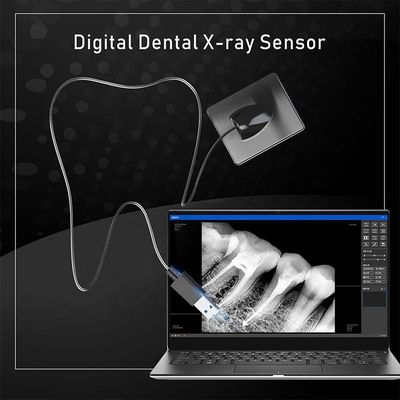 Οδοντική μηχανή ακτίνας X USB για πολλές χρήσεις, ασύρματη φορητή οδοντική μονάδα ακτίνας X