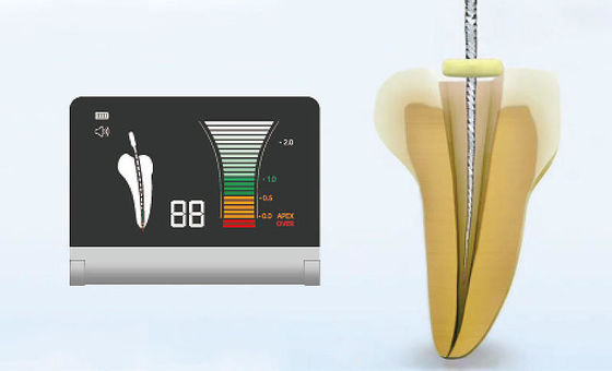 Μηχανή 50-60Hz Endo εντοπιστών κορυφών κραμάτων αργιλίου για την επεξεργασία καναλιών ρίζας